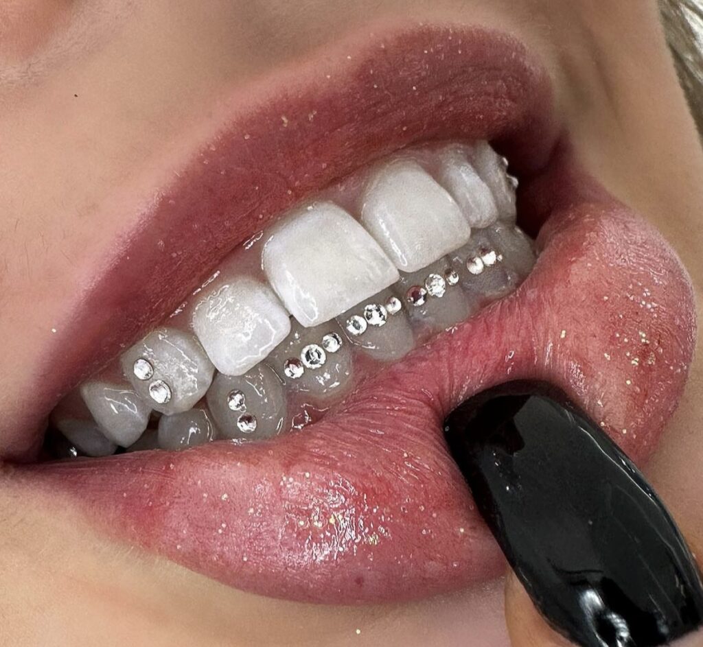 Teeth Whitening/Tooth Gems - Voila Lash & Beauty